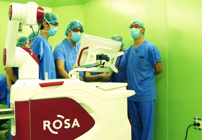 Robot Rosa phẫu thuật thần kinh trong một lần được sử dụng năm 2017. Ảnh: Bệnh viện Bạch Mai